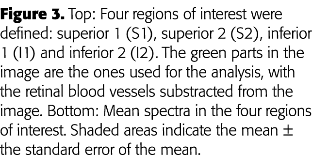 Figure 3  Top: Four regions of interest were defined: superior 1 (S1), superior 2 (S2), inferior 1 (I1) and inferior    