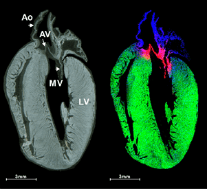 Two images of rate heart showing how mass spectrometry imaging can identify the position of N-glycans