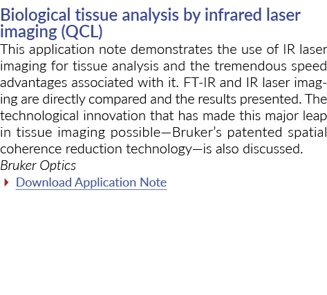 Biological tissue analysis by infrared laser imaging (QCL) This application note demonstrates the use of IR laser ima   
