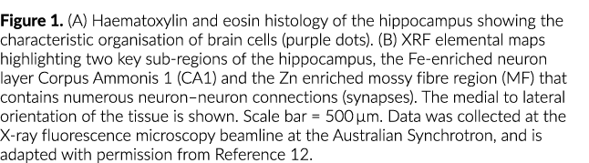 Figure 1  (A) Haematoxylin and eosin histology of the hippocampus showing the characteristic organisation of brain ce   