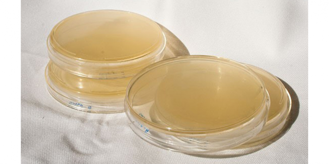 Photo of agar plates