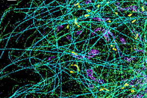 Spectrally resolved super-resolution microscopy image of four sub-cellular targets that were labelled by four far-red dyes at 10-nm spectral separation.