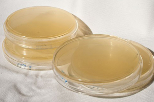 Photo of agar plates