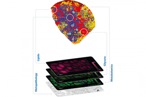 Scan of brain with various MS images from different regions