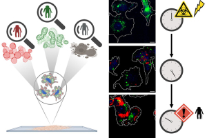 Therapy-induced senescent" (TIS) cells in treated tumour cells