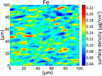 Distribution of Ca, S and Fe in a section of diffuse astrocytoma. Image: Diamond Light Source