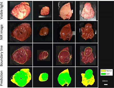 The machine learning technique developed by Dr Takemura and team could distinguish tumour tissue from healthy tissue in ex vivo images of resected tumours, with 86 % accuracy. Photo courtesy: Hiroshi Takemura, Tokyo University of Science