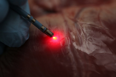 A new ablation catheter incorporating NIR spectroscopy mapping can successfully distinguish various tissue types in hearts. This distinction is critical when using radiofrequency ablation to treat heart rhythm problems. Credit: Christine P. Hendon, Columbia University. Photographer: John Abbott