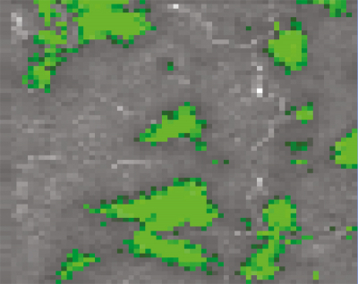 The digitally produced image illustrates how biochemical changes in the pancreas may be studied with the described method, without the need for labelling with external markers. The green structures correspond to an accumulation of beta-sheet proteins which indicate the development of type 2 diabetes. Image:Ulf Ahlgren