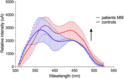Excitation spectra of urine samples of patients with malignant melanoma and controls. Taken from Open Chemistry (doi.org/d6g8), CC-BY.