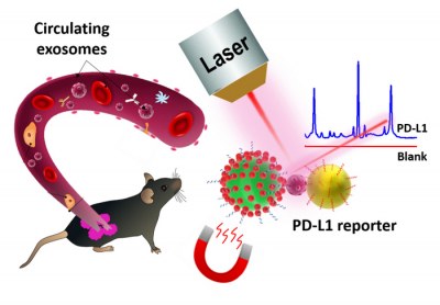 Schematic representation of circulating exosomal PD-L1 detection using SERS-sandwich. Credit: Muhammad Schematic representation of circulating exosomal PD-L1 detection using SERS-sandwic