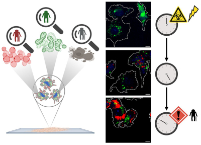 Therapy-induced senescent" (TIS) cells in treated tumour cells