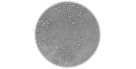 Microscope image of yeast cells