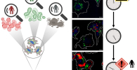 Therapy-induced senescent" (TIS) cells in treated tumour cells