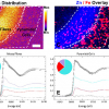 Images of metals in the brain