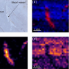 Light and mass spectromert imaging of tissue samples