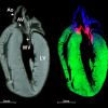 Mass spectrometry image of rat heart