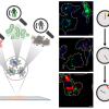 Therapy-induced senescent" (TIS) cells in treated tumour cells